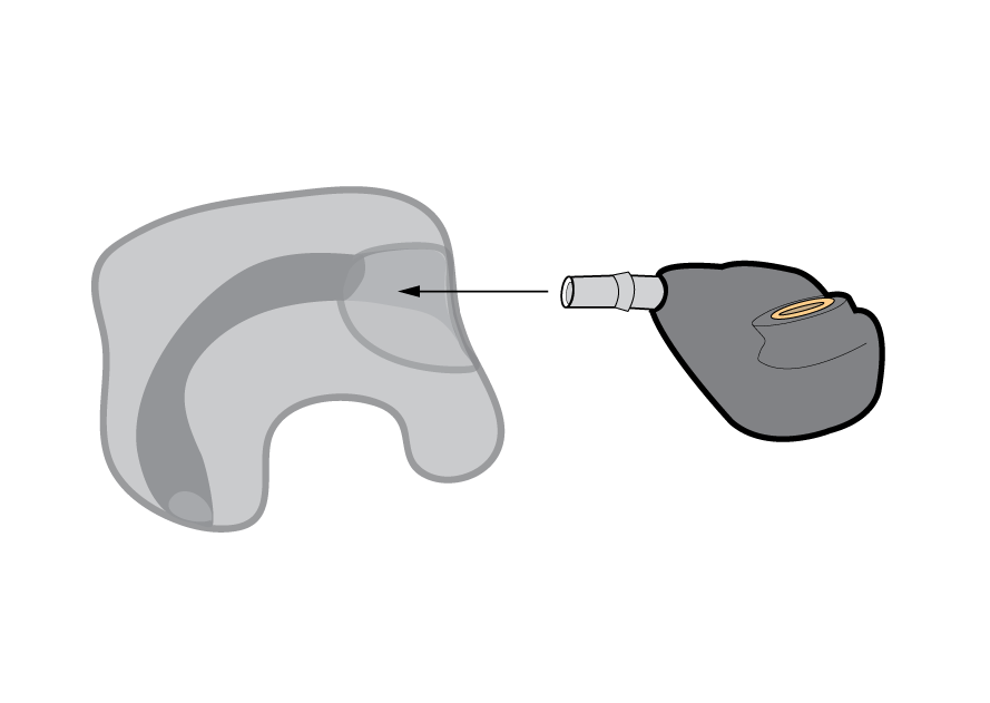 Handling & Insertion - Step 1 Handling & Insertion - Step 1