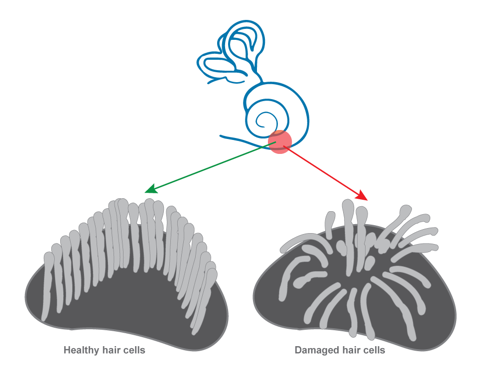 Hearing cells - London Ear Lab